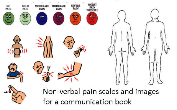 5 Ways to Use Rating Scales to Enhance Communication with AAC